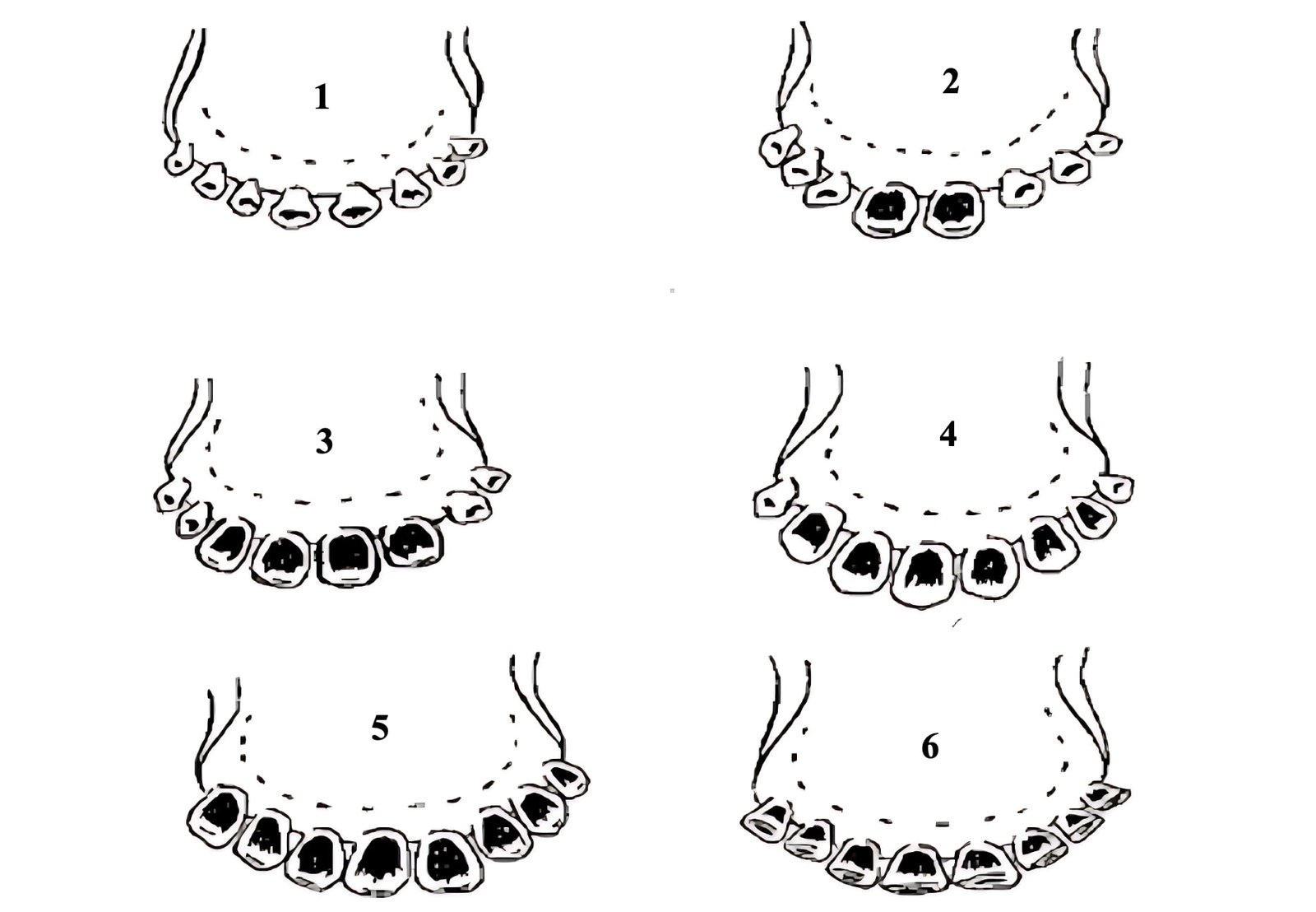 Estimation of Age by Dentition in Sheep and Goats